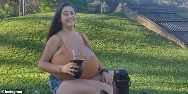 Breaking: Brazilian Woman with Rare Gigantomastia Shares Her Journey as Medical Community Rises to Aid
