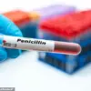 Expert Warn: Outdated Medical Records Fuel Penicillin Allergy Misconceptions and Threaten Antibiotic Resistance