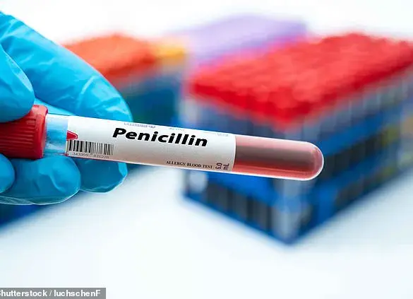 Expert Warn: Outdated Medical Records Fuel Penicillin Allergy Misconceptions and Threaten Antibiotic Resistance