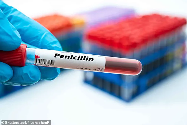 Expert Warn: Outdated Medical Records Fuel Penicillin Allergy Misconceptions and Threaten Antibiotic Resistance