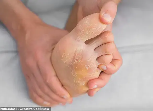 Expert Warns: Common Foot Care Mistakes Pose Hidden Health Risks