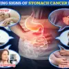 Helicobacter pylori Linked to 76% of Global Stomach Cancer Cases, Warn Scientists of Millions of Lives at Risk