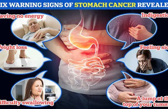 Helicobacter pylori Linked to 76% of Global Stomach Cancer Cases, Warn Scientists of Millions of Lives at Risk