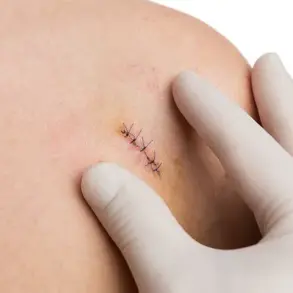 Invasive but Essential: The Role of Biopsies in Diagnosing Serious Illnesses and the NHS's Prostate Cancer Burden
