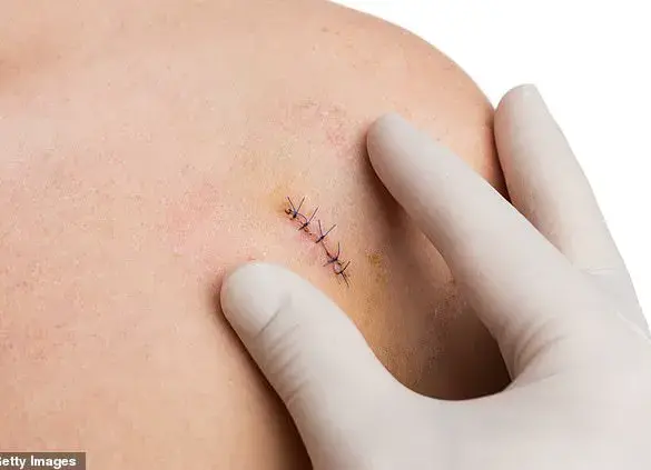 Invasive but Essential: The Role of Biopsies in Diagnosing Serious Illnesses and the NHS's Prostate Cancer Burden