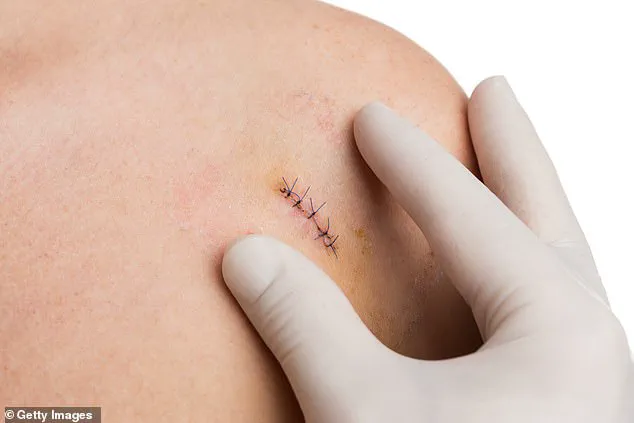 Invasive but Essential: The Role of Biopsies in Diagnosing Serious Illnesses and the NHS's Prostate Cancer Burden