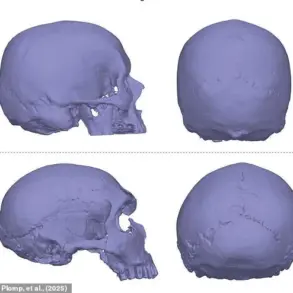 New Study Links Neanderthal Genes to Chiari Malformations, Tying Ancient Heritage to Modern Headache Risks