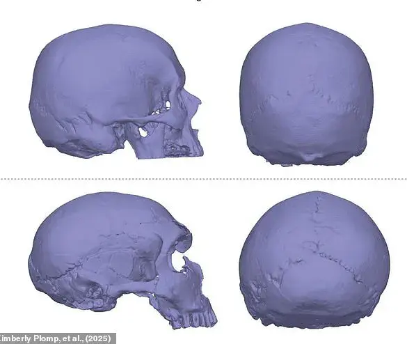 New Study Links Neanderthal Genes to Chiari Malformations, Tying Ancient Heritage to Modern Headache Risks