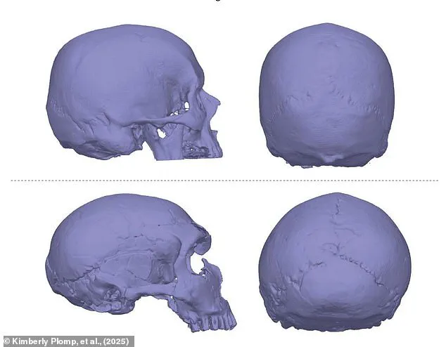 New Study Links Neanderthal Genes to Chiari Malformations, Tying Ancient Heritage to Modern Headache Risks