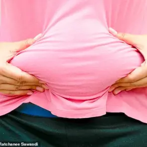 Rising Obesity Linked to Tripling of Cancer Deaths in U.S. Over Two Decades, Analysis Reveals