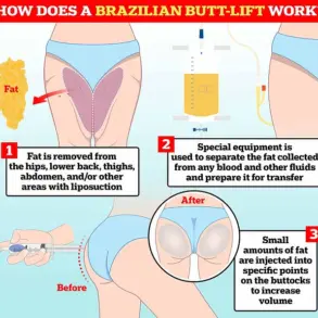 Tragic Death of Police Officer Wildelis Rosa Following Brazilian Butt Lift Surgery in Miami
