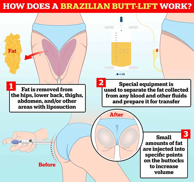 Tragic Death of Police Officer Wildelis Rosa Following Brazilian Butt Lift Surgery in Miami