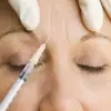 UKHSA Issues Urgent Warning Over Unlicensed Botox-Like Product Linked to Botulism Outbreak in UK