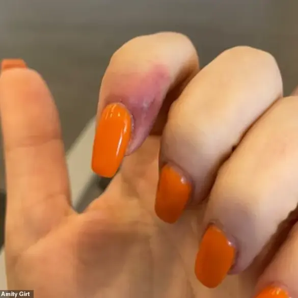 Woman Files Lawsuit Against Portland Nail Salon, Alleging Herpes Infection from Manicure