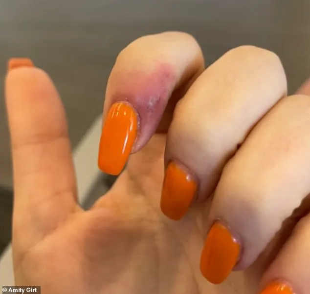 Woman Files Lawsuit Against Portland Nail Salon, Alleging Herpes Infection from Manicure