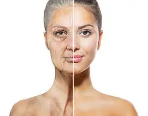 Aquagenic Wrinkling May Signal Underlying Health Conditions, Experts Warn