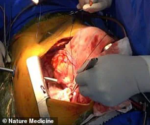 Behind Closed Doors: First Pig Lung Transplant into Human Highlights Limited Access to Xenotransplantation Milestone