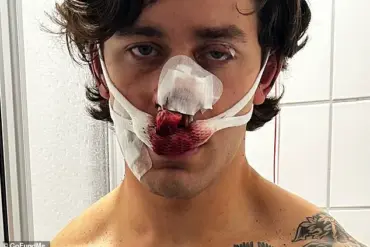 Brutal Attack on Paramedic Model Sparks International Outrage as Germany Condemns Incident