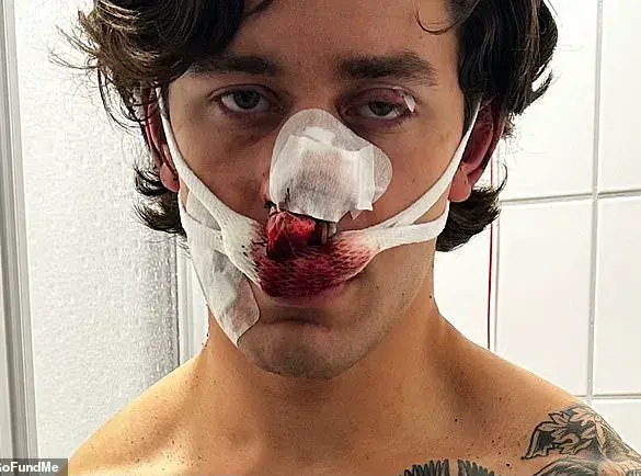 Brutal Attack on Paramedic Model Sparks International Outrage as Germany Condemns Incident