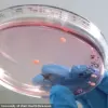 CRISPR-Cas9 Breakthrough Enables Chromosome 21 Deletion in Down Syndrome Cells