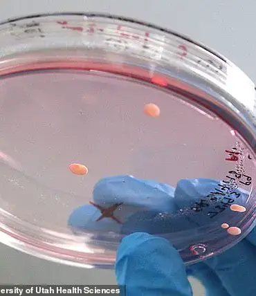 CRISPR-Cas9 Breakthrough Enables Chromosome 21 Deletion in Down Syndrome Cells