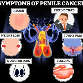 Leading Doctor Warns: 'Man Boobs' Could Signal Deadly Diseases, Urging Immediate Medical Check