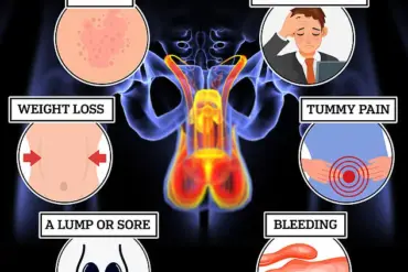 Leading Doctor Warns: 'Man Boobs' Could Signal Deadly Diseases, Urging Immediate Medical Check