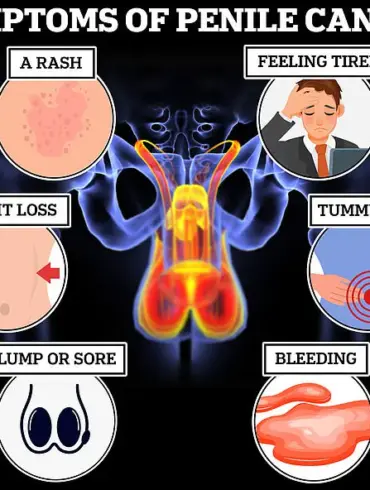 Leading Doctor Warns: 'Man Boobs' Could Signal Deadly Diseases, Urging Immediate Medical Check