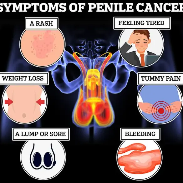 Leading Doctor Warns: 'Man Boobs' Could Signal Deadly Diseases, Urging Immediate Medical Check