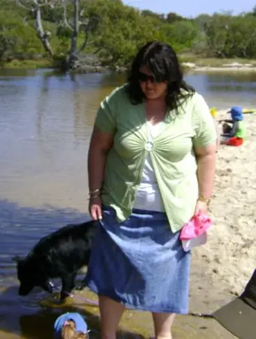 Life-Altering Event Thwarts Kylie's Gastric Sleeve Surgery Plans