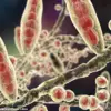 Stark Warning: Crusty Heels May Signal Life-Threatening Fungal Infection, GP Warns