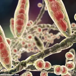 Stark Warning: Crusty Heels May Signal Life-Threatening Fungal Infection, GP Warns