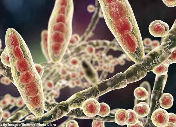 Stark Warning: Crusty Heels May Signal Life-Threatening Fungal Infection, GP Warns