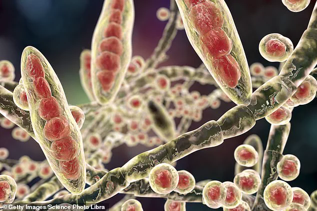 Stark Warning: Crusty Heels May Signal Life-Threatening Fungal Infection, GP Warns