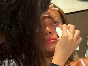 The Hidden Risks Behind the Allure of Lash Serums: A Growing Concern for Consumers