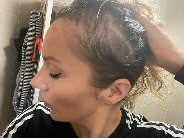 The Sun's Embrace: A Lifeline for Defiance Against Hair Loss