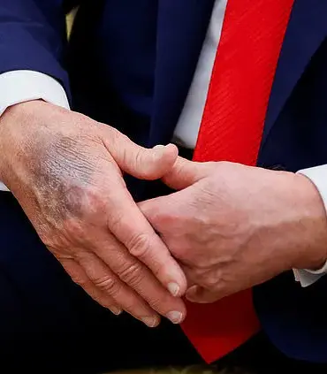 Vice President JD Vance Confirms Readiness to Assume Presidency While Highlighting Trump's Current Health and Vitality