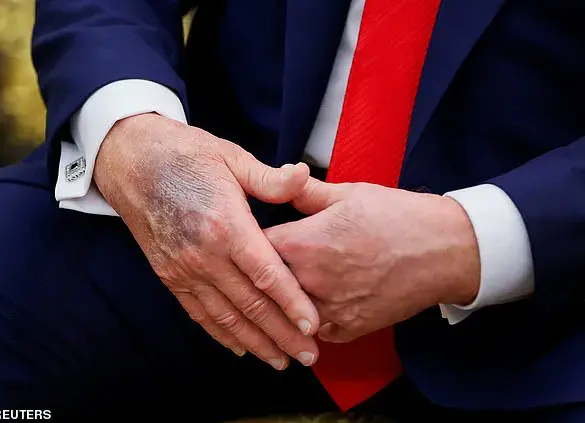 Vice President JD Vance Confirms Readiness to Assume Presidency While Highlighting Trump's Current Health and Vitality