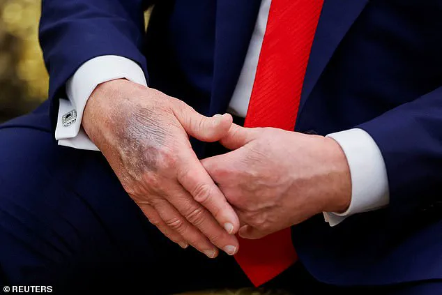 Vice President JD Vance Confirms Readiness to Assume Presidency While Highlighting Trump's Current Health and Vitality