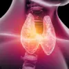 Rising Thyroid Disorders in UK Women Prompt Focus on Mediterranean Diet as Potential Solution